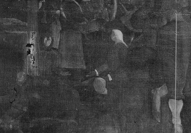 A Centennial of Independence:X-ray of removed family group