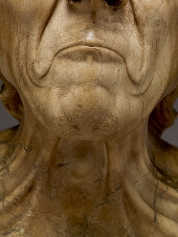 The Vexed Man:Dimples