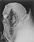X-ray images of the head