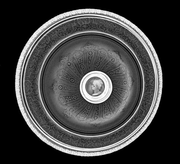 X-radiograph top-view of the lidded bowl where the decorations on the outer ring, middle ring, and knob are white while the rest of the lid is gray.