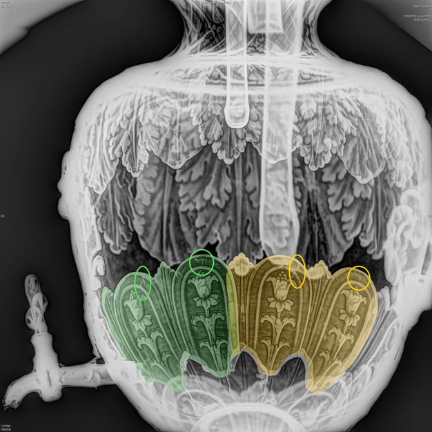 X-radiograph of a fountain's main body with two arches in the vessel's skirt highlighted green, two highlighted yellow, and four circles pointing out flaws in each arch.