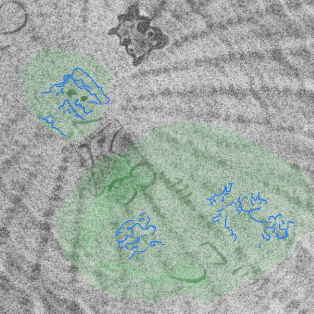 Close-up of a x-radiograph with green highlights and blue markings on two dots at the top and two numbers at the bottom.