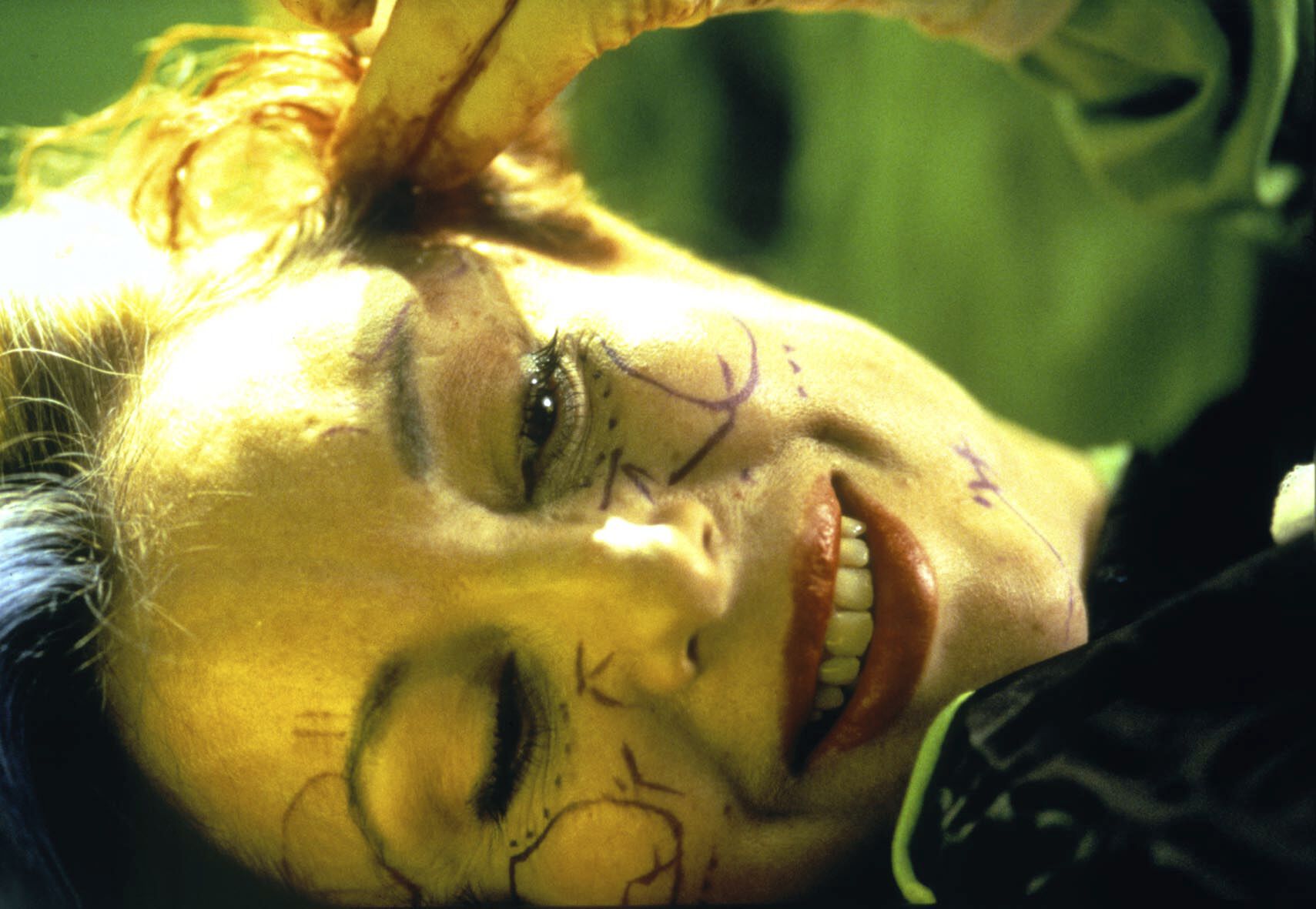 Artist ORLAN smiling as she lays on the left side of her cheek with surgical marking cover her face as a doctor inspects her face