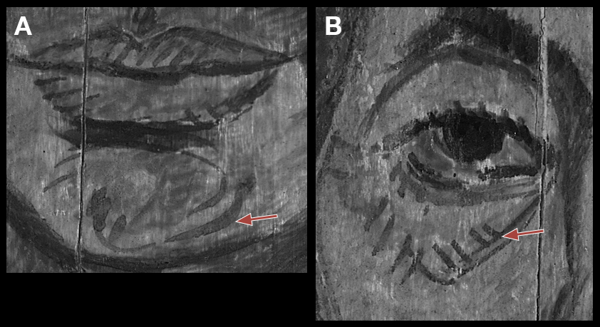 Infrared reflectogram images of the mouth and eye from portrait E of an elderly lady. The arrow in image A points to the underdrawing of the chin where the brushstroke is visible. The arrow in image B points to the underdrawing beneath the eye; the brushstrokes are thick and short.