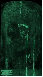 An overall dark image with speckles of green scattered throughout the portrait indicating the presence of calcium across.