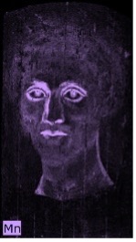 Portrait of a man in which the outline of his eyes, nose, and lips is shown in purple indicating the presence of manganese in these areas.