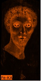 Portrait of a man where the contour of the face and facial features appears in bright orange indicating the presence of iron pigments in these areas. His entire face is shaded in light orange.