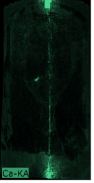 A black image with a bright green vertical line running down the middle of the portrait indicating the presence of calcium.
