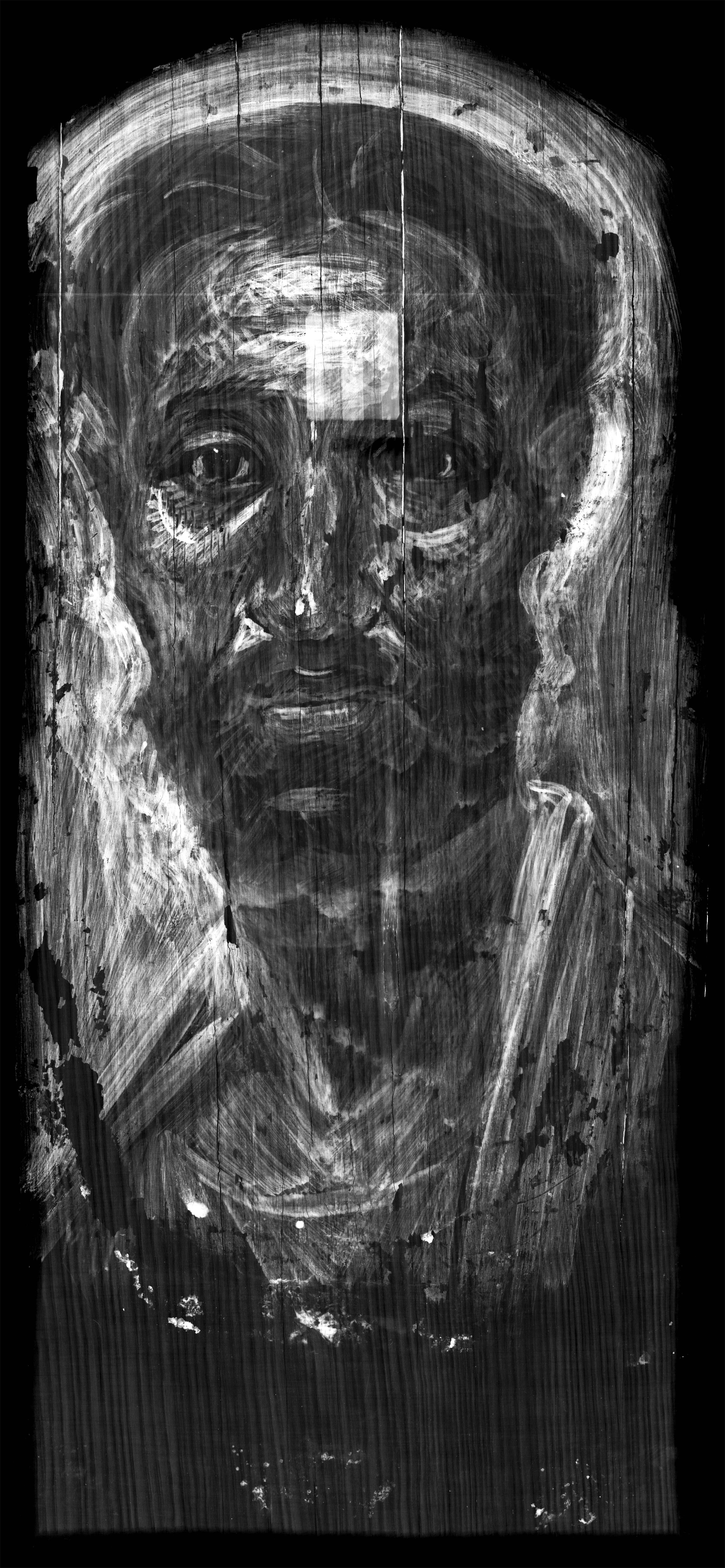 Grayscale image of the portrait of a man indicating in bright white the presence of lead on the man's forehead and background. Most of the image appears dark.