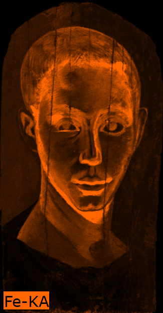Portrait of a man where the contour of the face and facial features appears in bright orange indicating the presence of iron pigments in these areas.