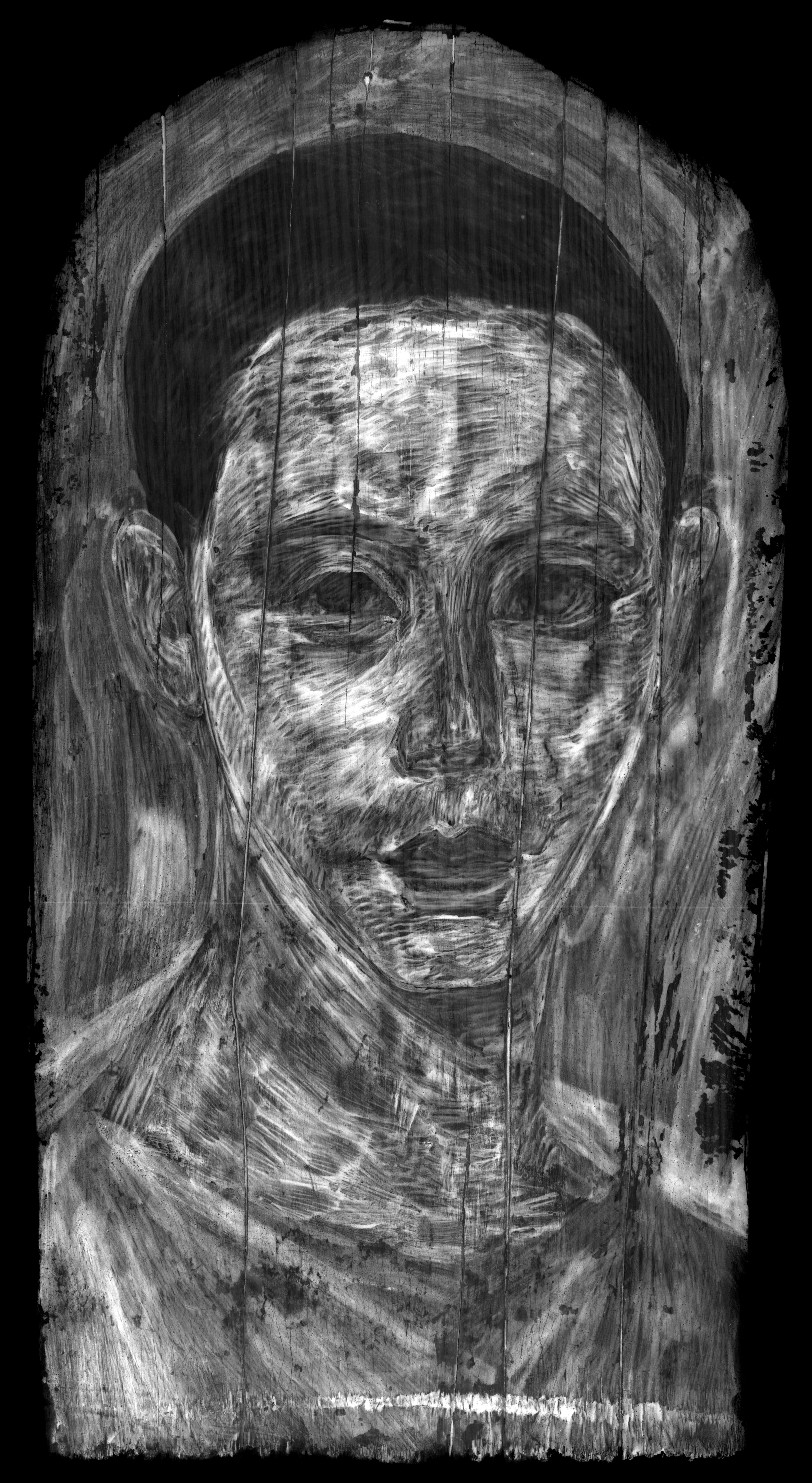 Grayscale image of the portrait of a man featuring white strokes throughout the face, neck, and clothing indicating the presence of lead. The hair appears black and the background is grey.