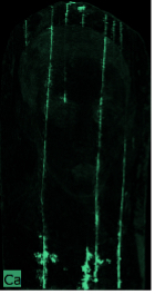 A black image with three bright green vertical lines across the extent of the portrait indicating the presence of calcium.