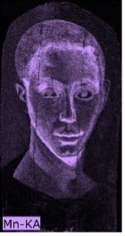 Portrait of a man where the contour of the face and facial features appears in bright purple indicating the presence of manganese in these areas. His hair, face, and neck are shaded in light purple.