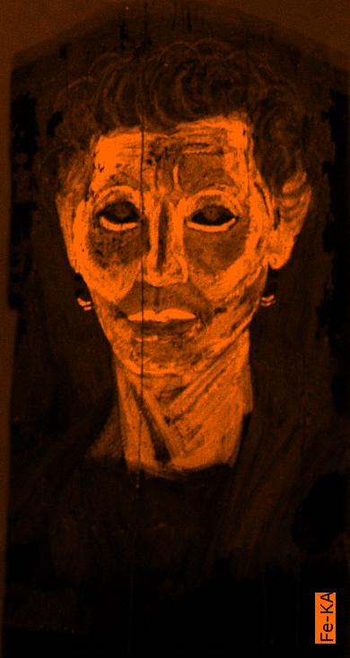 Portrait of an older person where the entire face is shaded in bright orange indicating the high presence of iron pigments.