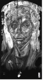 Grayscale image of the portrait of an older person where the background appears bright white. Most of the individual's face is shown in different shades of grey and the neck and clothing areas appear dark.