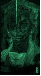Portrait of an individual shaded in different tones of light green indicating the presence of calcium. The robes worn by the individual depicted appear in a brighter green.