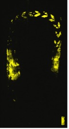 Image mapping the presence of gold in a portrait by showing in black the silhouette of a person's head and upper body and indicating in bright yellow a wreath headband and the area of the background to the sides of the person's neck.