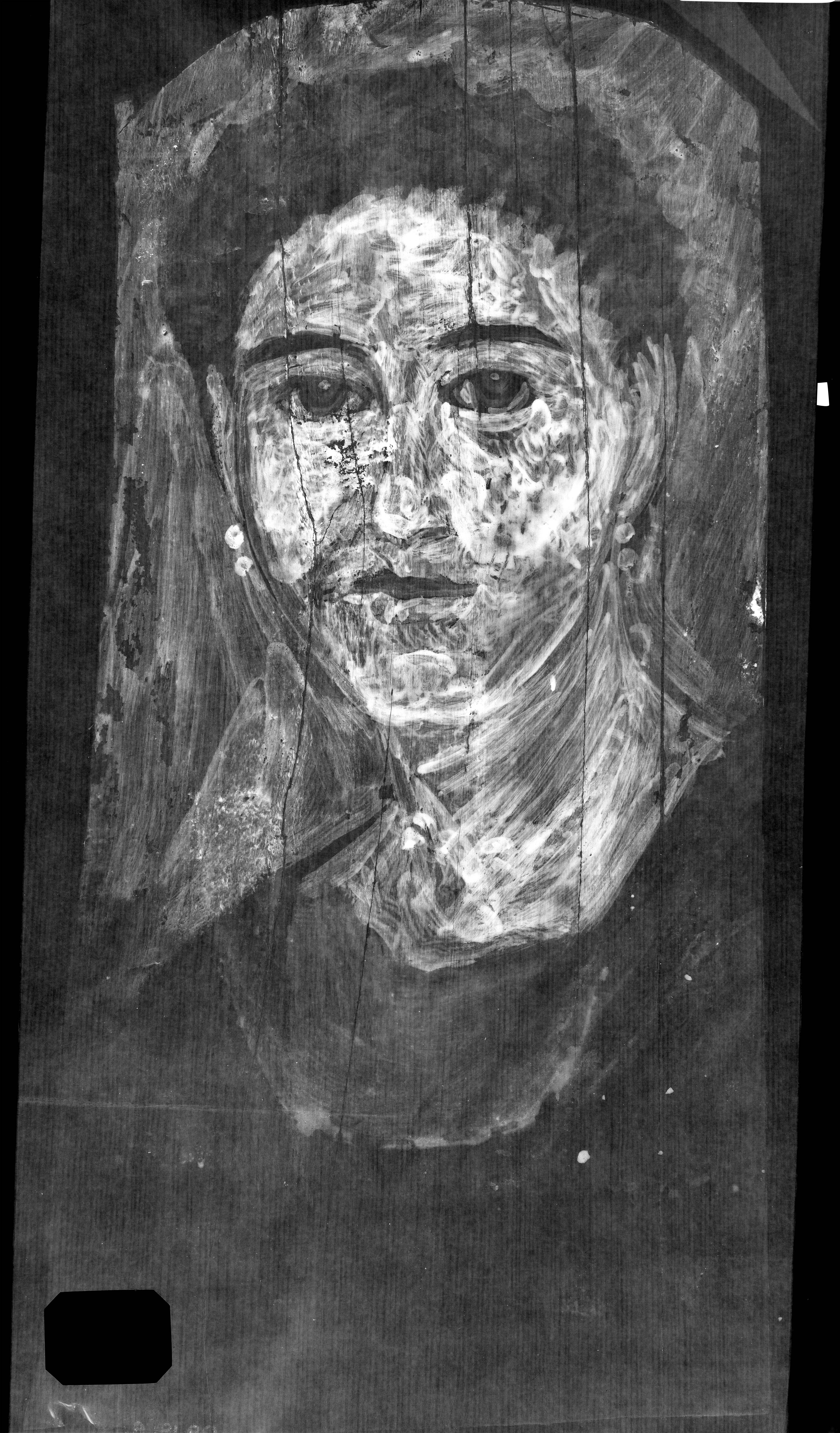 Grayscale image of the portrait of a woman indicating in bright white the presence of lead across her face.
