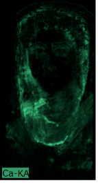 A dark image showing in bright green the area corresponding to the individual's neck and the background immediately adjacent to their head.