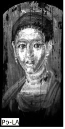 Grayscale image of the portrait of a woman indicating in bright white the presence of lead across her face.