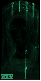 A black image with four short bright green vertical lines coming down from the top section of the portrait and one running up from the bottom edge indicating the presence of calcium.