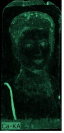 A predominantly black image where the hair, eyes, mouth, and the area underneath the chin of the portrayed child appear in light green indicating the presence of calcium. There is also a bright green line on the bottom left corner that corresponds to one of the red vertical stripes running down the individual's tunic.