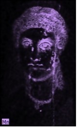 Portrait of a woman where her hair, eyes, jawline, and necklace appear in purple indicating the presence of manganese in these areas.