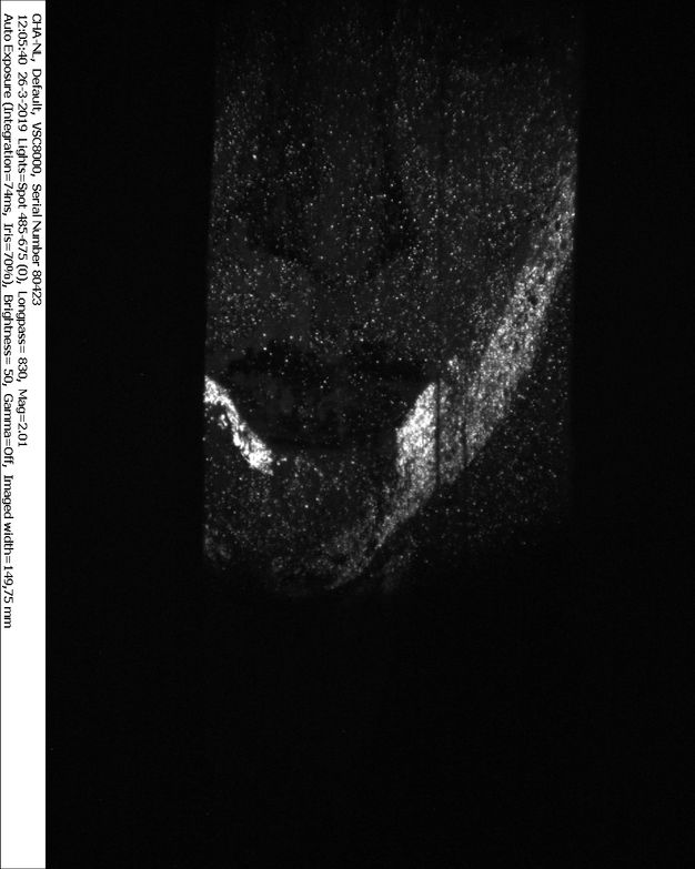 VIL image of the lower half of the lady's face in the fragment in figure 1.2. Most of the image is dark except for a light gray area under her chin.