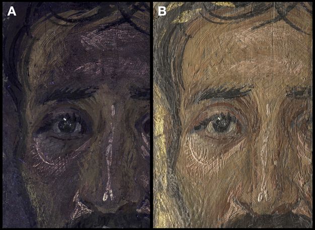 Two images of the same portrait under different lighting conditions. In both views, only the man's left eye is showing, as well as his nose and some of his hairline. Image A is an ultraviolet illumination. The image is dark, and a purple color can be seen on his forehead, nose, and cheeks. There are white streaks to highlight his nose, cheeks, and forehead. Image B shows the same image in raking light. He has brown eyes and dark hair.