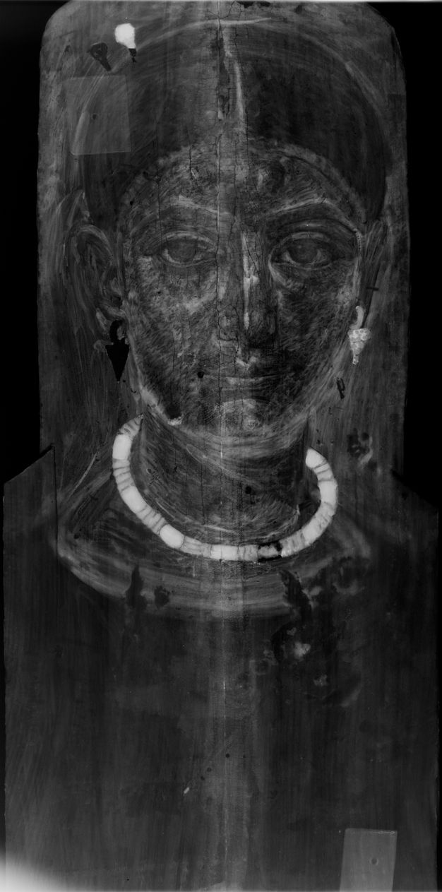 X-radiograph of a woman's portrait. The image is very dark throughout, but her necklace, left earring, and one of her hairpins appear in bright white.