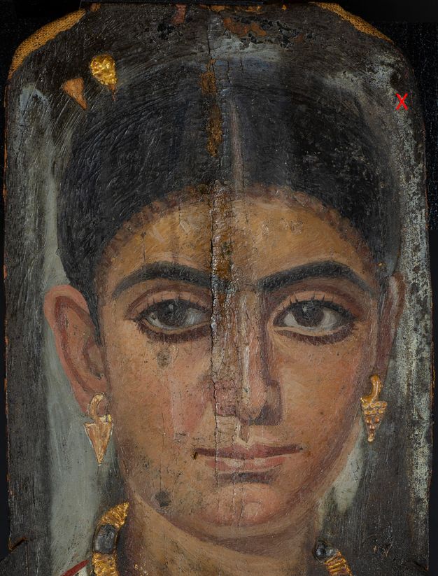 Portrait of a woman with gold jewelry and earrings featuring a red cross to the right of the woman's head marking the location of the photomicrograph in figure 14.8.